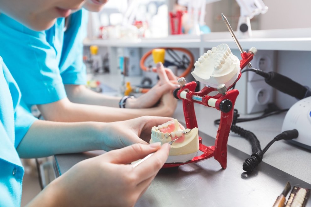 fabricación de implantes dentales